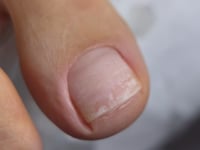 2-in-1 Macro Camera Lens for Smartphone – Macro & Wide-Angle